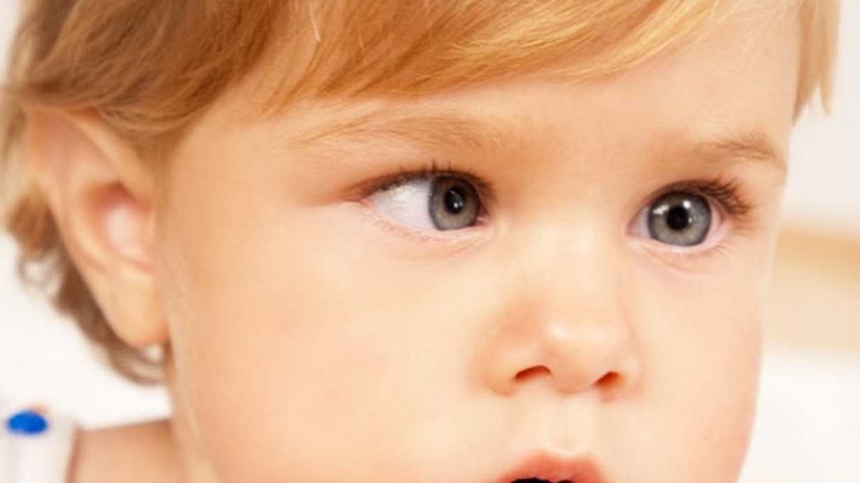 أسباب حول العين