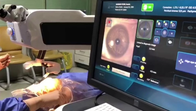 ماهو سبب الماء الابيض في العين د. محمد عبد الكريم | المحلة الكبرى