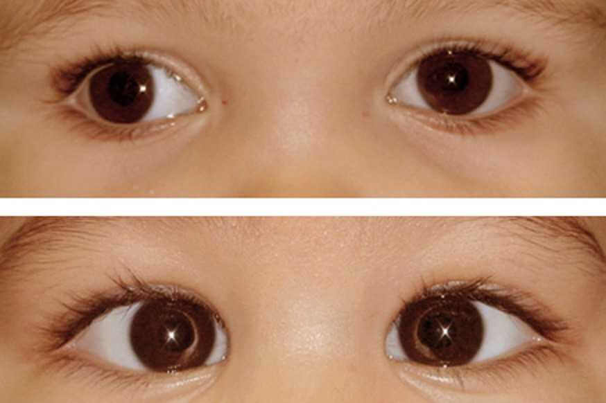 أفضل عيادة لإجراء عملية حول العين عيادة د. محمد عبد الكريم | المحلة الكبرى